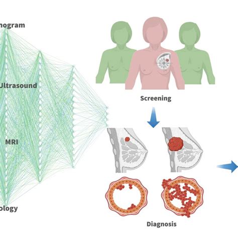 the villages breast cancer detection|Deep learning.